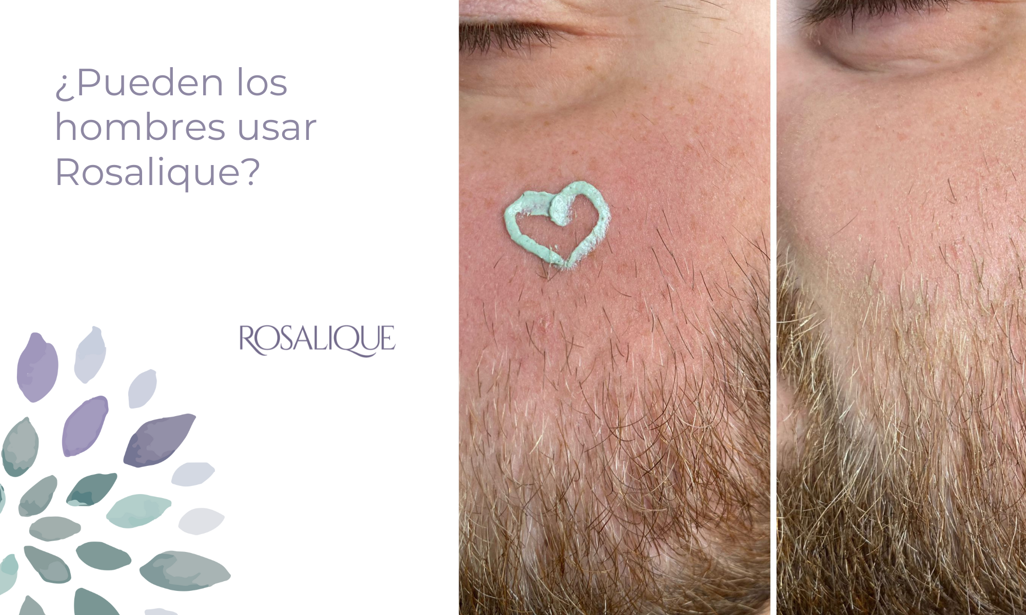 ¿Pueden los hombres usar Rosalique?