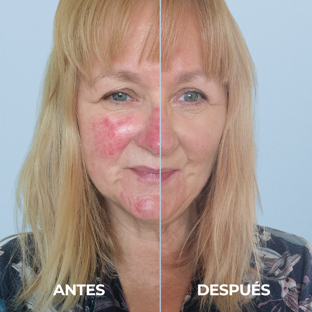 Rosalique 3 in 1 Anti-Redness Miracle Formula SPF50