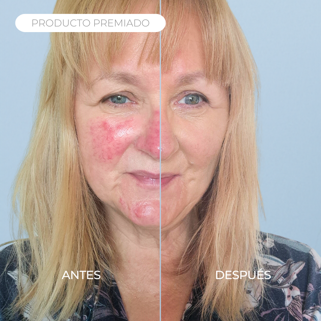 Rosalique 3 in 1 Anti-Redness Miracle Formula SPF50 Sample 3ml