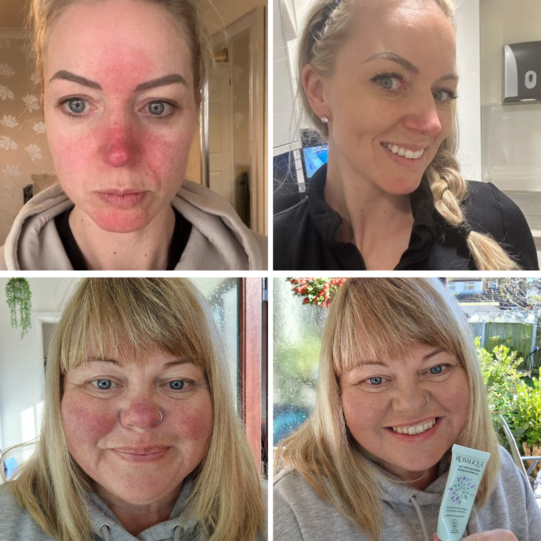 Rosalique Christmas Gift Set