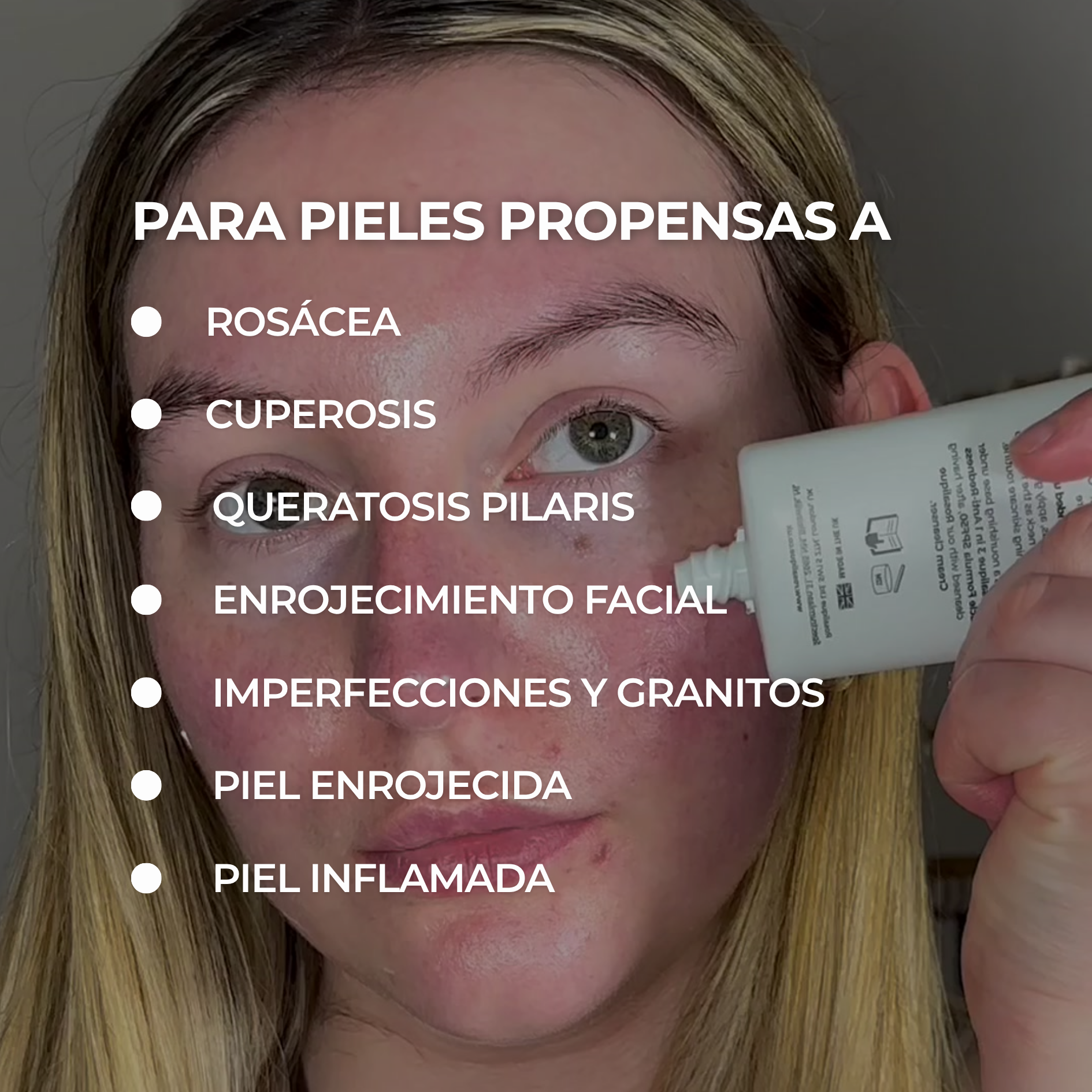 Rosalique Redness Relief Day Cream