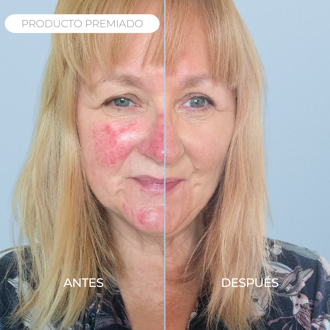 Rosalique 3 in 1 Anti-Redness Miracle Formula SPF50